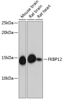 FKBP12 Rabbit mAb