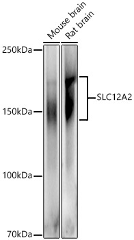 SLC12A2 Rabbit pAb
