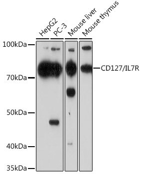 CD127/IL7R Rabbit mAb