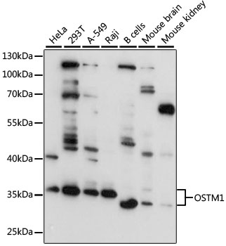 OSTM1 Rabbit pAb