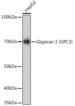 Glypican 3 (GPC3) Rabbit mAb