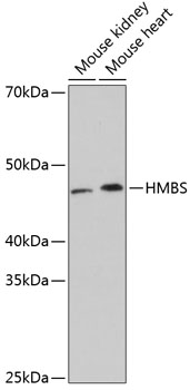 HMBS Rabbit mAb