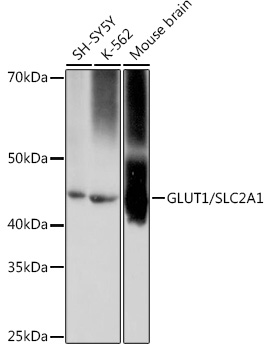 GLUT1/SLC2A1 Rabbit mAb