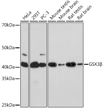 GSK3_ Rabbit mAb