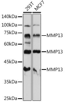 [KO Validated] MMP13 Rabbit pAb