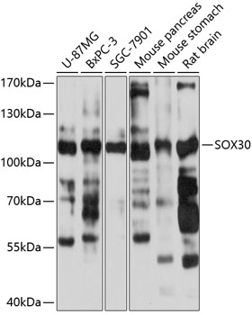 SOX30 Rabbit pAb