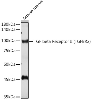 TGF beta Receptor II (TGFBR2) Rabbit pAb