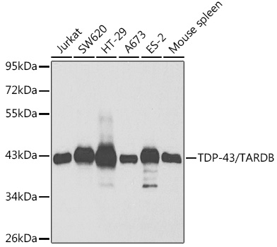 TDP-43/TARDB Rabbit pAb