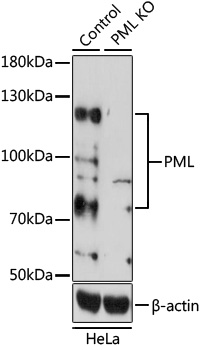 [KO Validated] PML Rabbit pAb