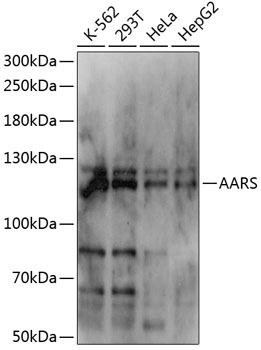 AARS Rabbit pAb
