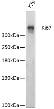 Ki67 Rabbit mAb