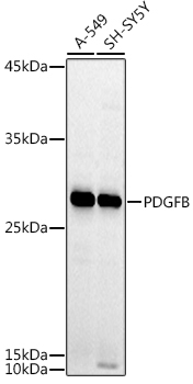 PDGFB Rabbit pAb