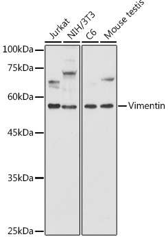 [KO Validated] Vimentin Rabbit pAb