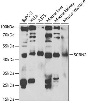 SCRN2 Rabbit pAb
