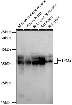 TPM3 Rabbit pAb