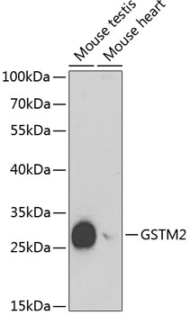 GSTM2 Rabbit pAb