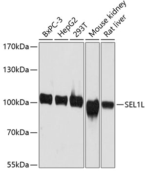 SEL1L Rabbit pAb