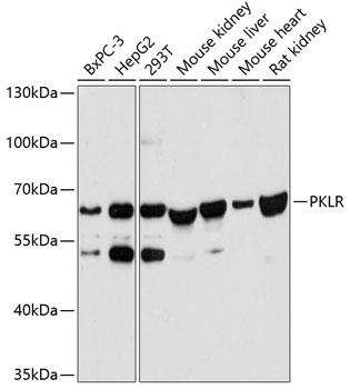 PKLR Rabbit pAb