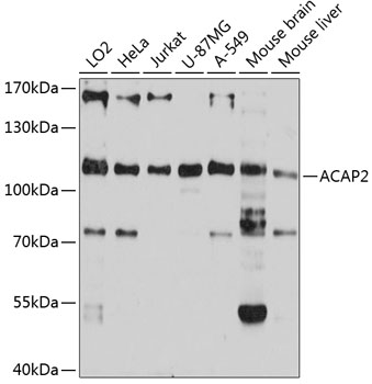 ACAP2 Rabbit pAb