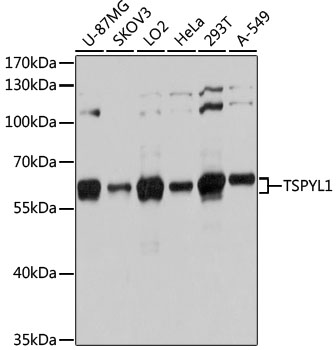 TSPYL1 Rabbit pAb