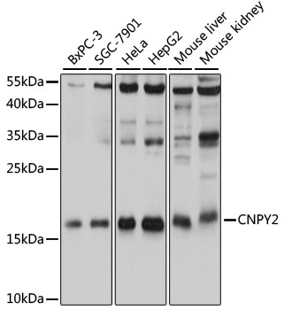 CNPY2 Rabbit pAb