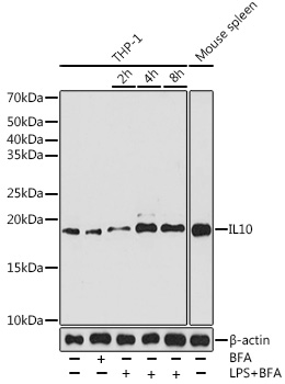 IL10 Rabbit mAb