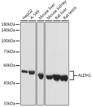 ALDH2 Rabbit pAb