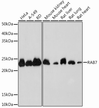RAB7 Rabbit mAb
