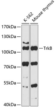 TrkB Rabbit pAb