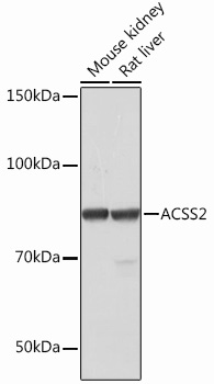 ACSS2 Rabbit mAb