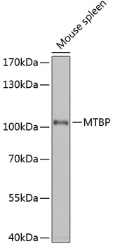 MTBP Rabbit pAb