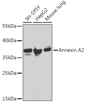 Annexin A2 Rabbit pAb