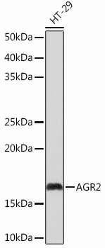 AGR2 Rabbit mAb