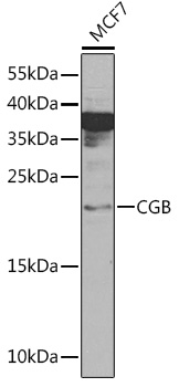 CGB Rabbit pAb