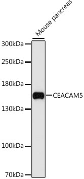 CEACAM5 Rabbit pAb
