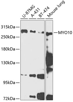 MYO10 Rabbit pAb