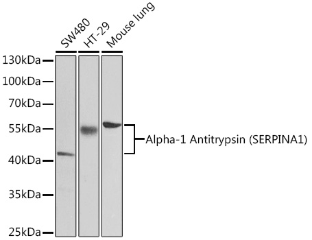 Alpha-1 Antitrypsin (SERPINA1) Rabbit pAb