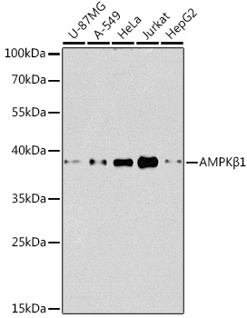 [KO Validated] AMPK_1 Rabbit pAb