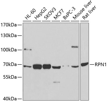 RPN1 Rabbit pAb