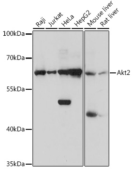 Akt2 Rabbit pAb