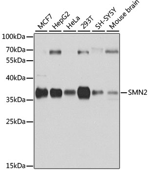 SMN2 Rabbit pAb