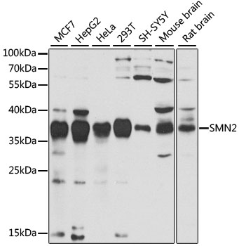 SMN2 Rabbit pAb