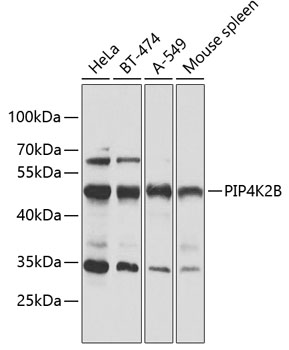 PIP4K2B Rabbit pAb