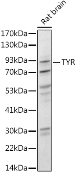 Tyrosinase Rabbit pAb
