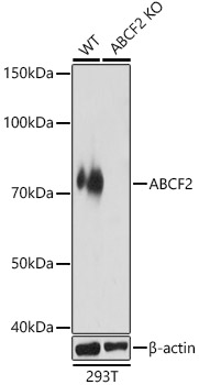 [KO Validated] ABCF2 Rabbit pAb