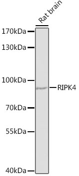 RIPK4 Rabbit pAb