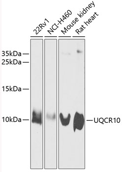 UQCR10 Rabbit pAb