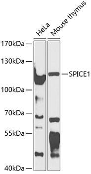 CCDC52 Rabbit pAb