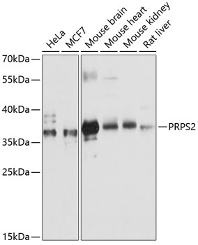 PRPS2 Rabbit pAb