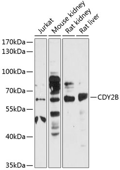 CDY2B Rabbit pAb